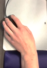 ulnar with wrist rest at mouse